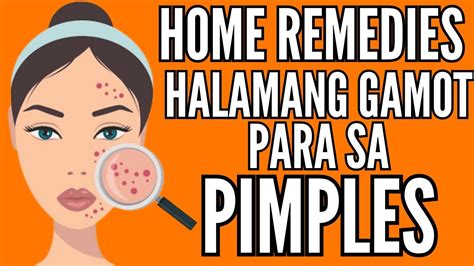sabon na pantanggal ng pimples|Paano Mawala ang Pimples: Helpful Tips to Fight Acne.